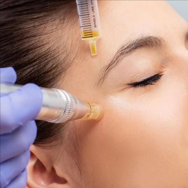 PRP Facial (Vampire Facial) at Beuxtique in Sugar Land, TX